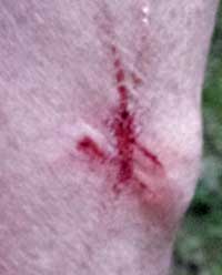 Just a little scratch, Behind: then a much bigger wound